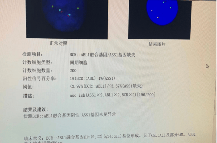 fish检测阴性用化疗吗