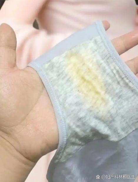 内裤发黄怎么洗干净缩略图