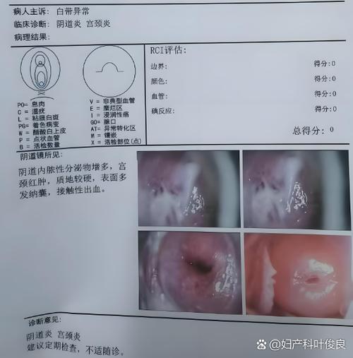 下体不自觉的流出液体是怎么回事