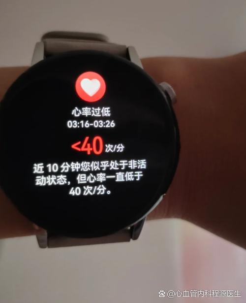 心率30-40有生命危险吗