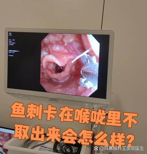 舌头有鱼刺弄不出来怎么办图标
