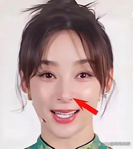 脸上紧绷绷的怎么回事