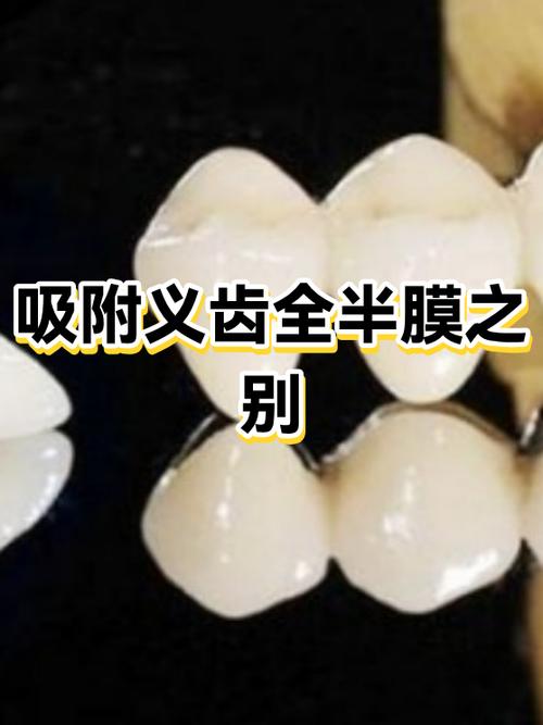 全膜和半膜哪个好图标