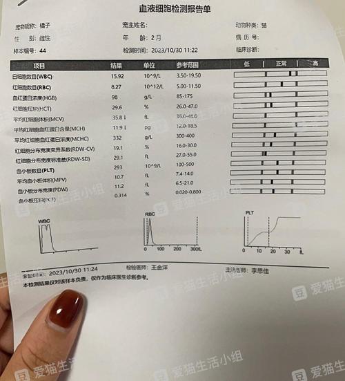 蓝牙耳机单耳好还是双耳好