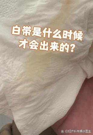 女生白带多怎么解决