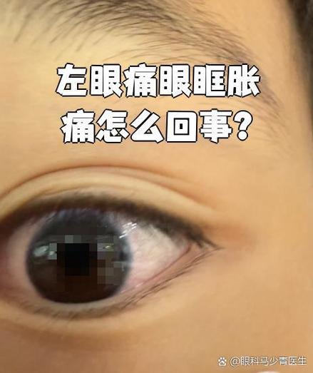 眼睛发胀不舒服