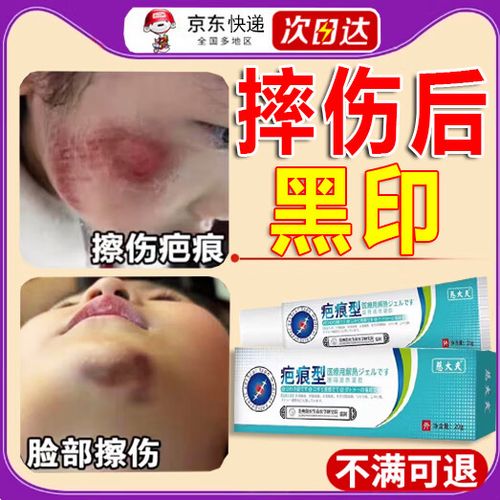 疤痕膏能去除黑色素沉着吗