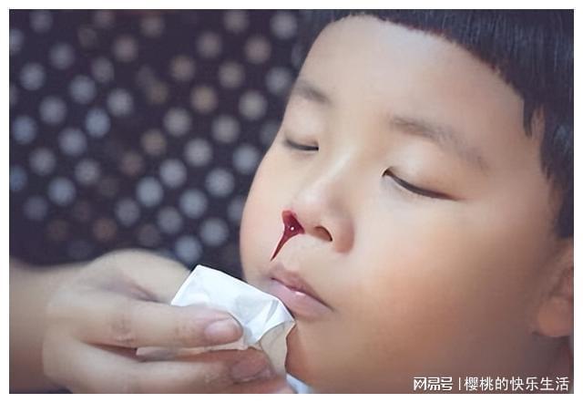 流鼻血什么程度算频繁