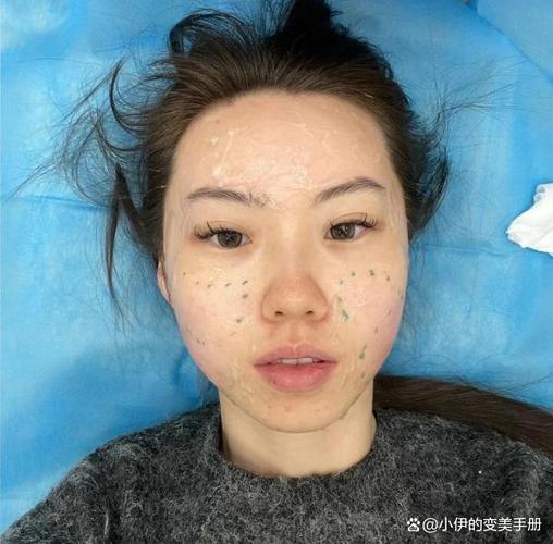 女性假脸皮