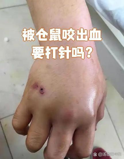 被仓鼠咬之后要打针吗