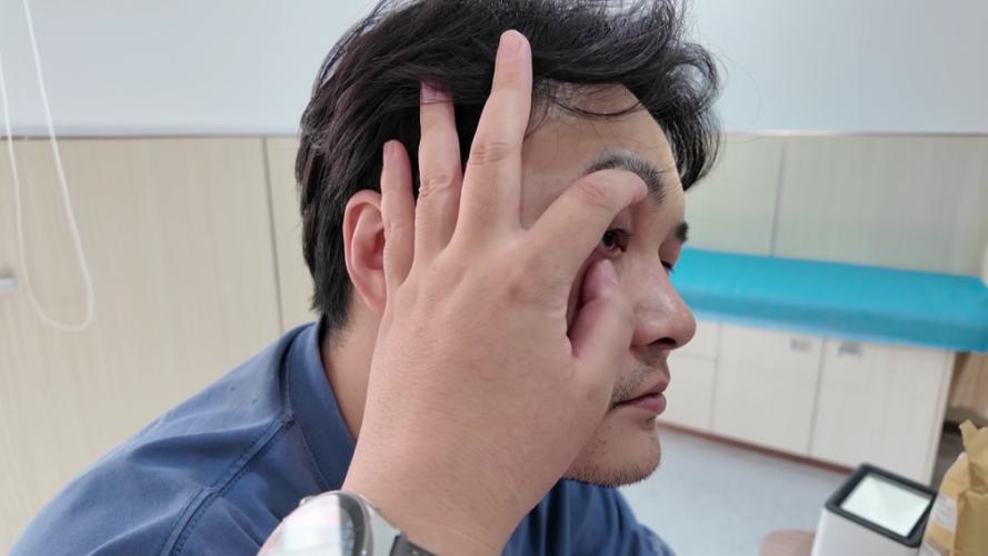 晕3d怎么治疗