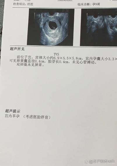 怀孕停胎是怎么造成的