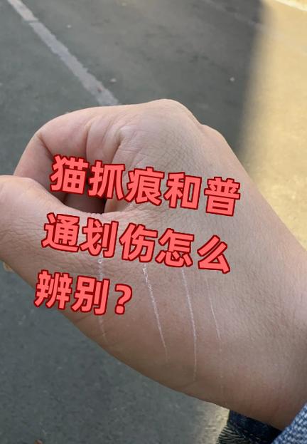 被猫抓了一条痕迹图标