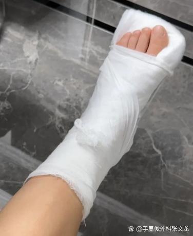 骨折恢复最快的方法图标