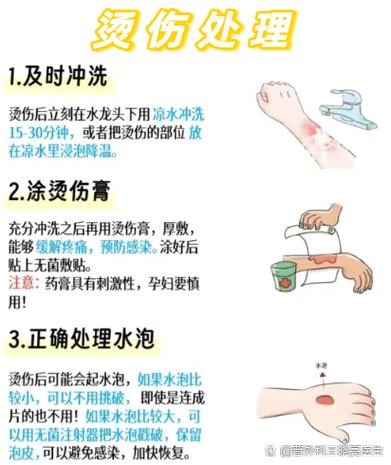 被开水烫到了怎么处理