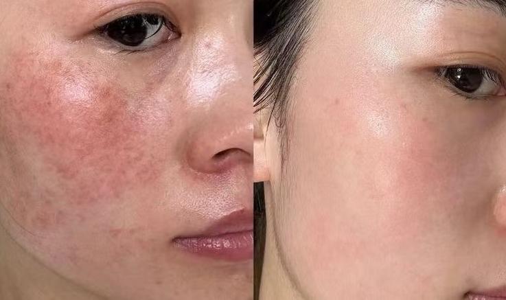 脸部皮肤修复图标