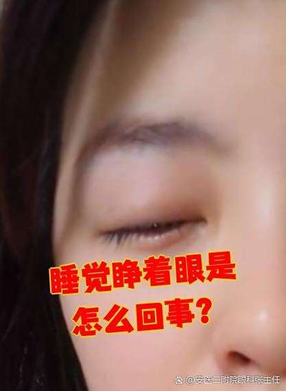 闭眼照片变睁眼软件