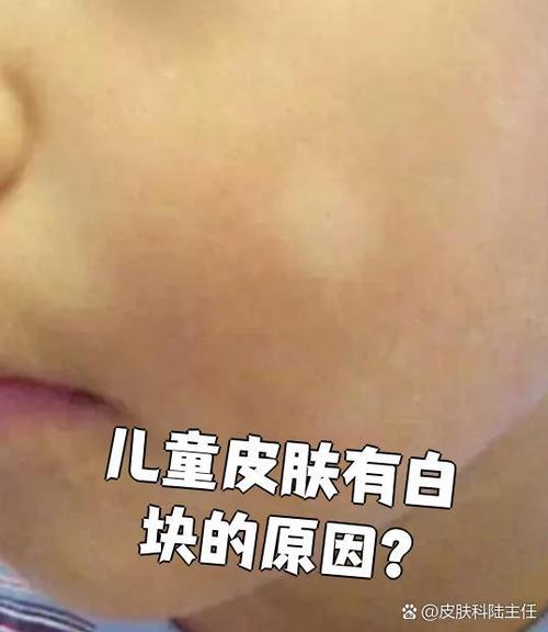皮肤出现可小的白块