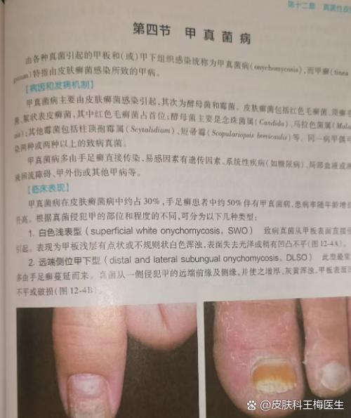 脚趾中间有一条竖线是什么