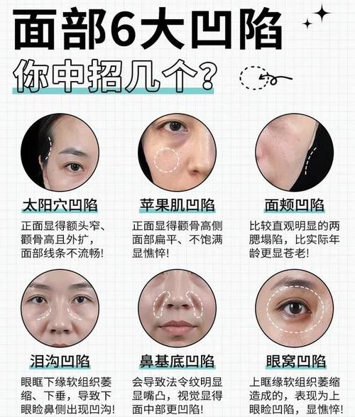 打了咬肌脸颊为什么凹陷了怎么办