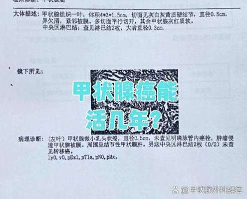 恶性甲状腺能活几年