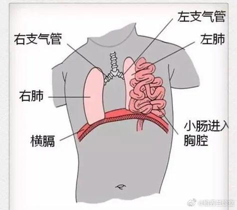 胸隔在什么部位