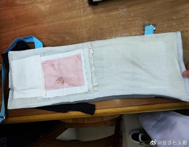 膏药可以贴在衣服上吗
