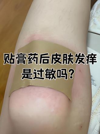 膏药弄到皮肤上如何快速清除截图