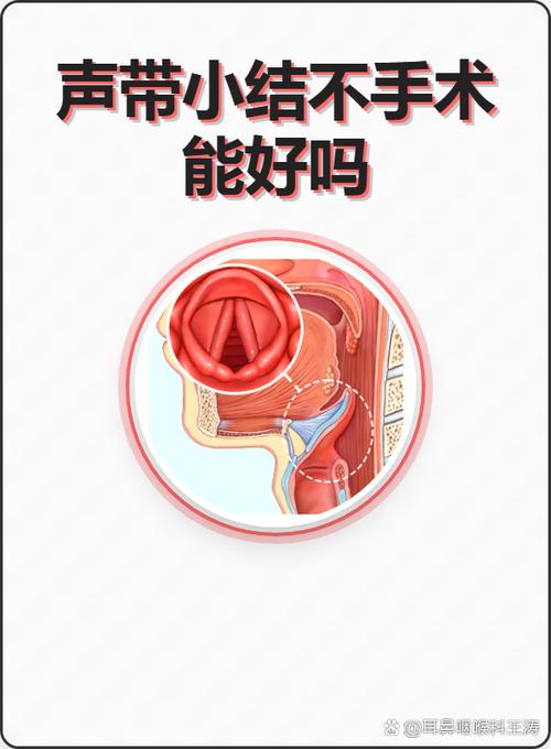声带小结可以自愈吗