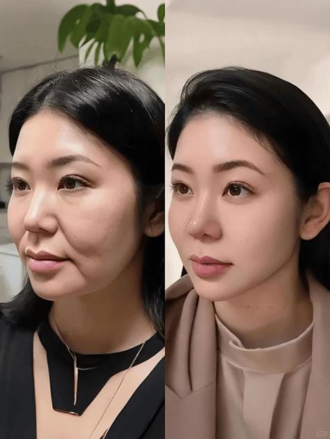 50岁抗皱紧致第一名