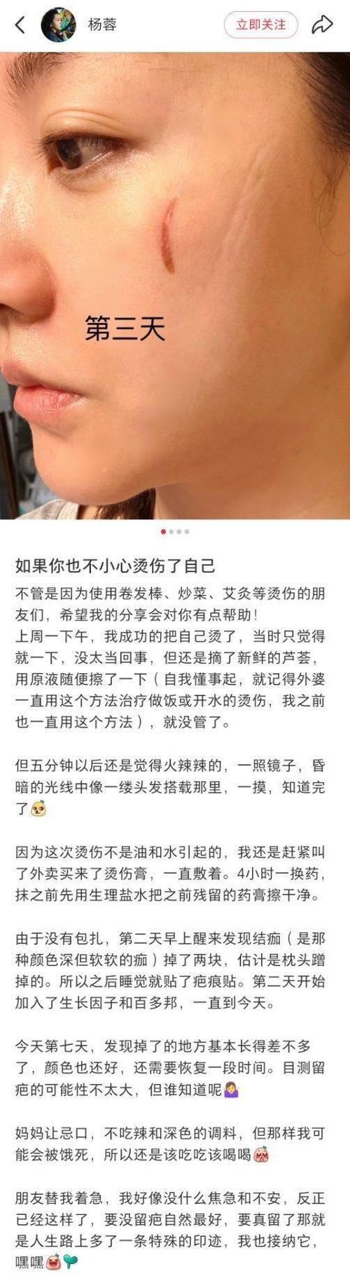形容疤痕的美丽的句子