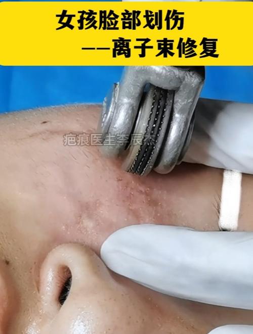 手术疤痕修复哪家医院好