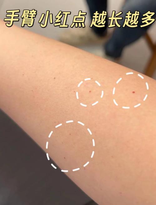 微信状态红点是有人看过吗