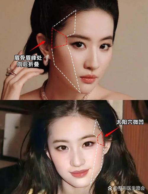 做太阳凹陷填充风险大吗