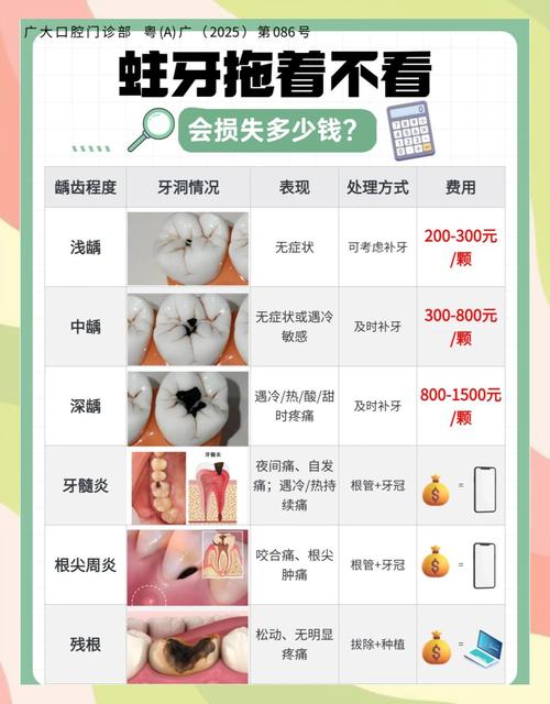 蛀牙修复多少钱一颗