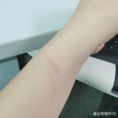 伤痕数据号生成器