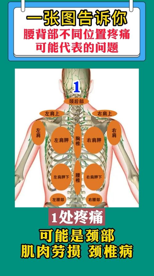 后腰疼痛部位对照表