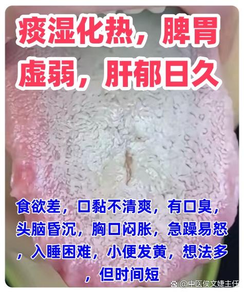 老感觉心烦气躁怎么办