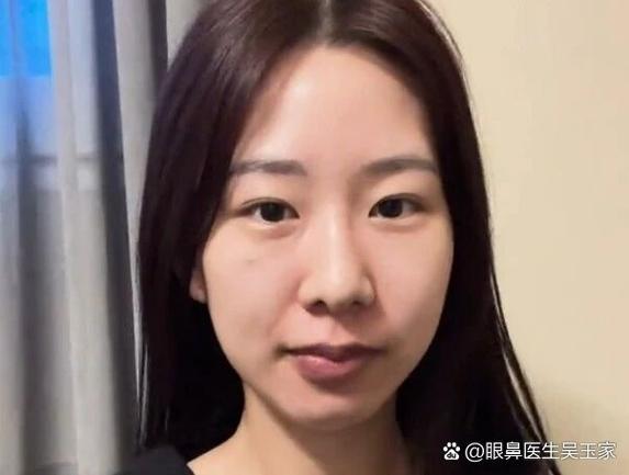 垫鼻子用什么最自然