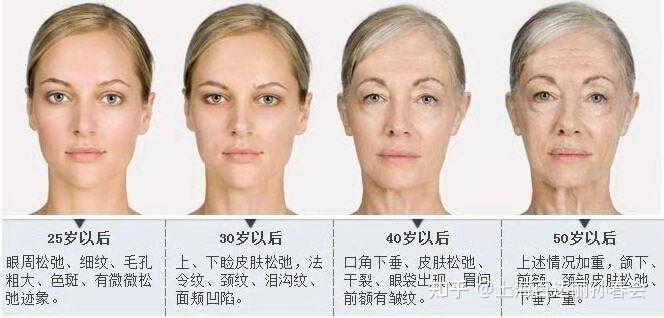 加速衰老的四个图标