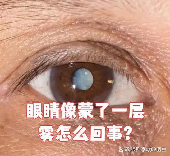 眼睛有一层雾蒙蒙的感觉游戏截图