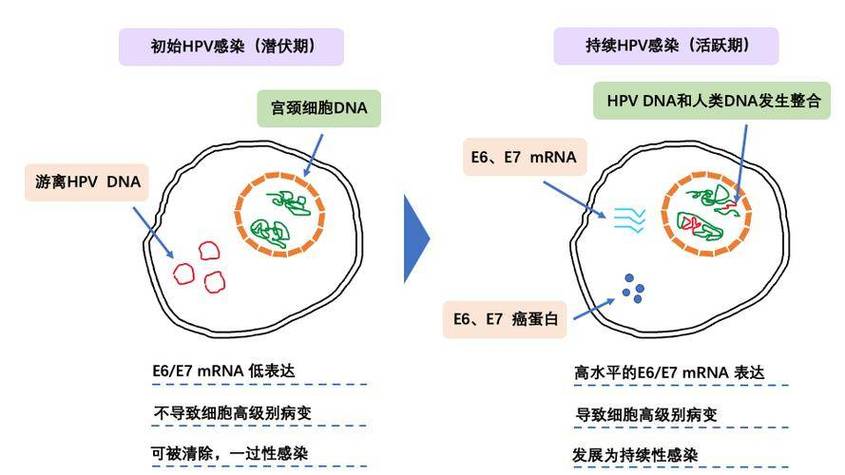 39型hpv病毒是什么引起的