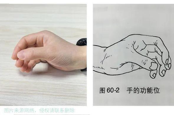 手指康复训练最佳方法