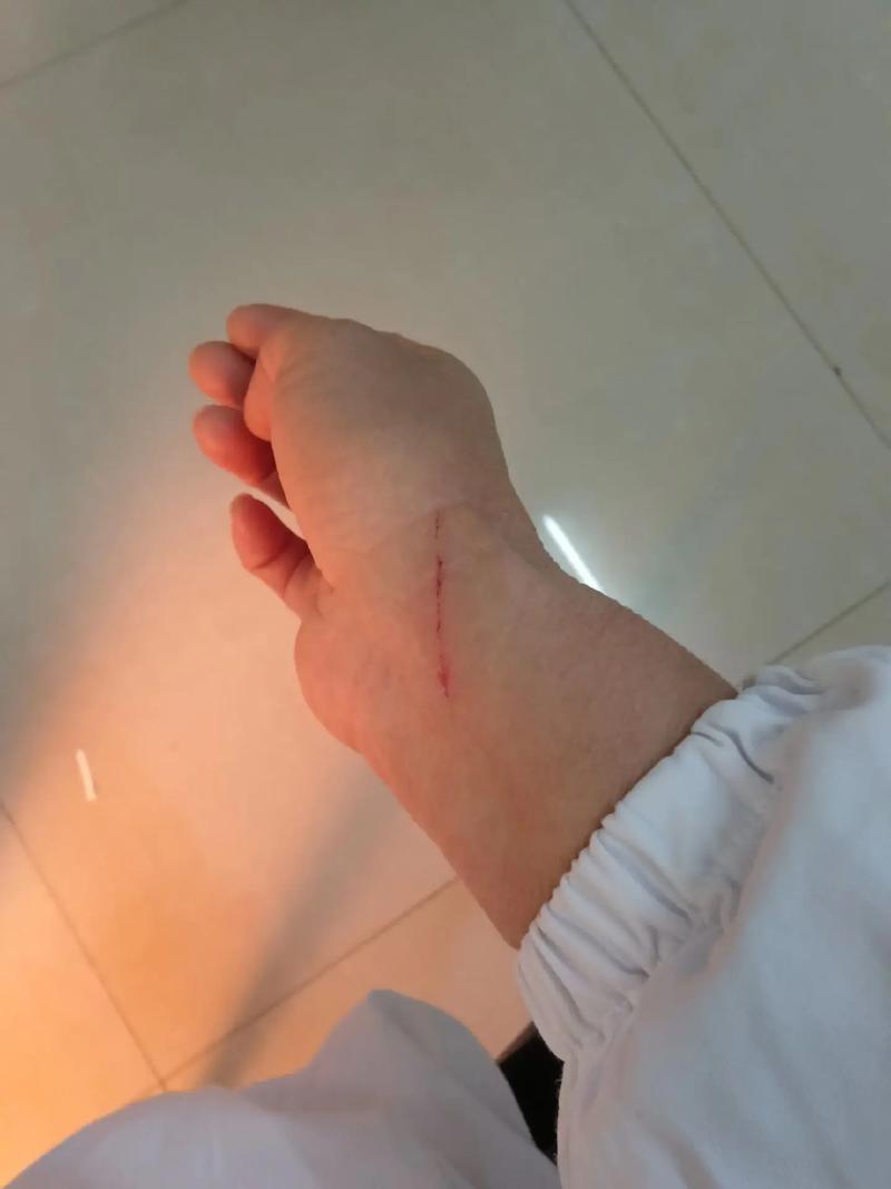 3u拍子很伤手腕吗