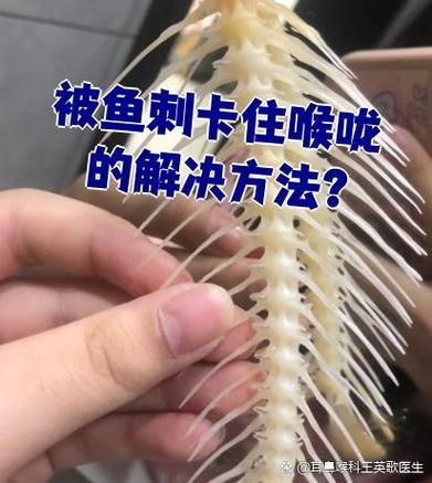 化解鱼刺最好的方法
