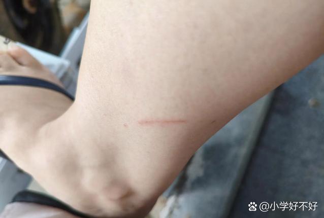 抓痕能长好吗