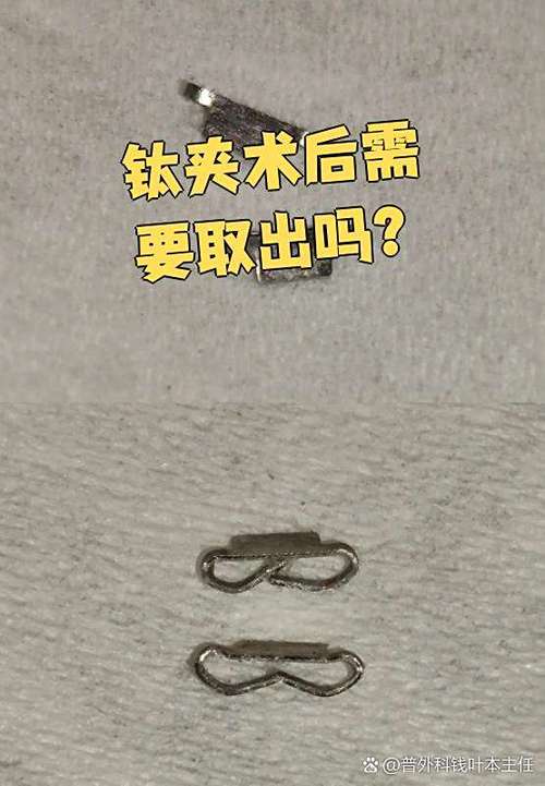 合金怎么做