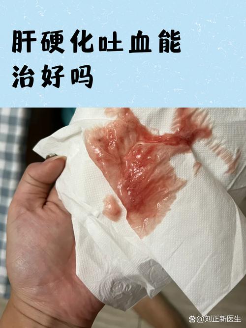早上起来口吐鲜血什么原因