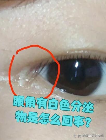 人的眼睛里有脏东西吗