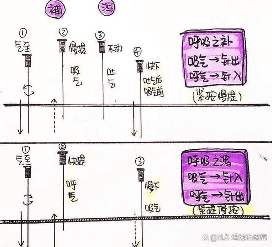 针灸的补泻手法